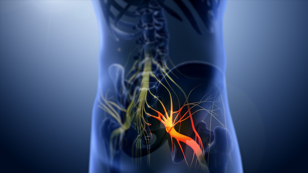 5-remedii-naturale-pentru-a-alina-nevralgia-sciatica.jpg